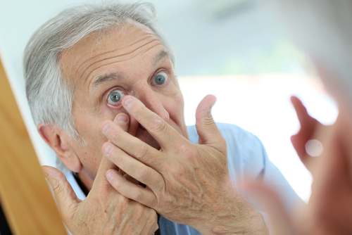 Older man with cataracts using contact lenses